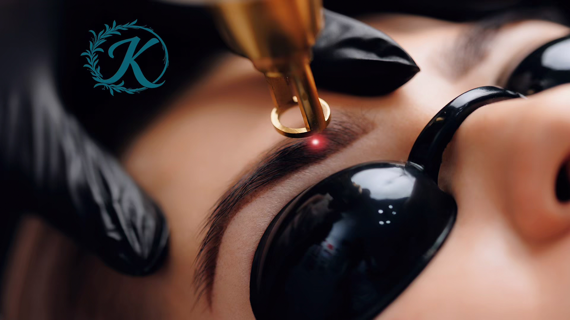 Keepsake Tattoo Removal